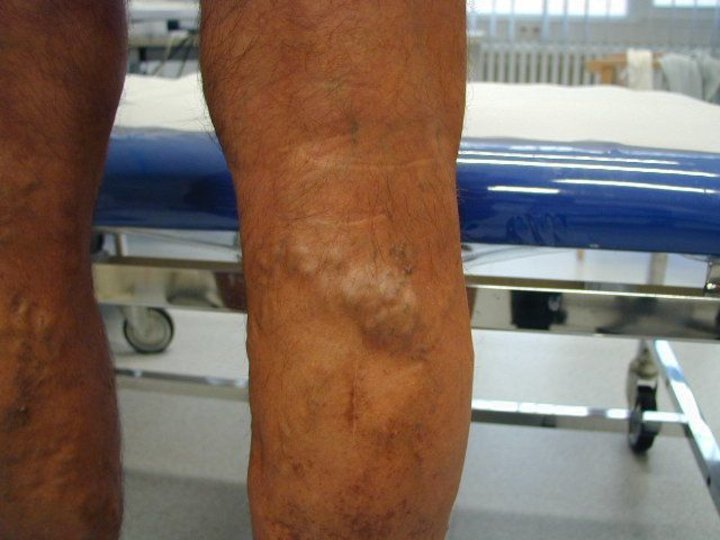 gesundheit nord klinikverbund bremen stellen gesundheit nord klinikverbund bremen stellen