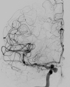 Angiographiebilder
