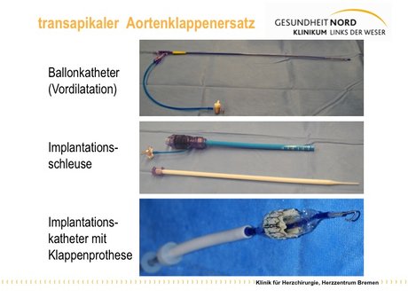 Abbildung 2: weiteres Material für den Eingriff (unterer Bildausschnitt: „Klappenstent wird zur Montage auf dem Ballonkatheter vorbereitet).