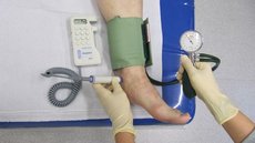 Abb. 6: Technik der Blutdruckmessung an den Füßen