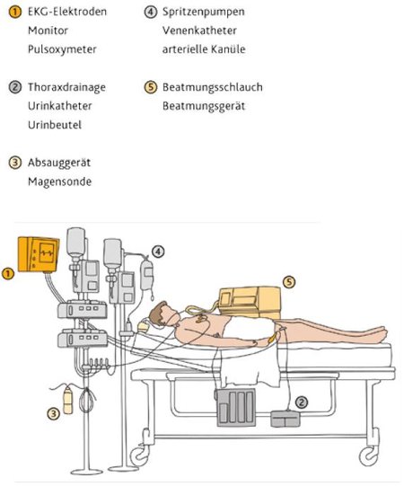 DER PATIENT AUF DER INTENSIVSTATION
