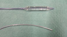 Dieser Vorgang heißt Ballondilatation oder perkutane transluminale Angioplastie (PTA).
