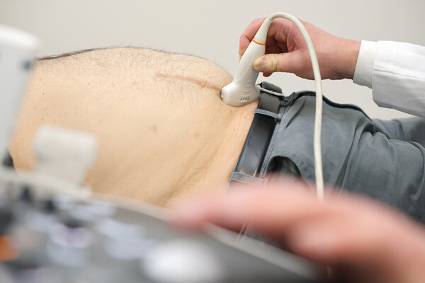 Ultraschalluntersuchung des Bauches