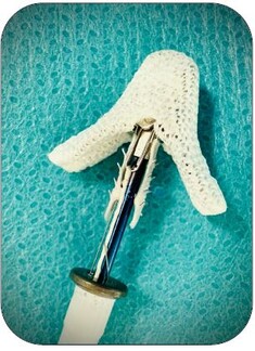 Das Bild zeigt einen MitraClip- das Gerät ist ein kleiner Metallclip, der mit einem Polyestergewebe überzogen ist