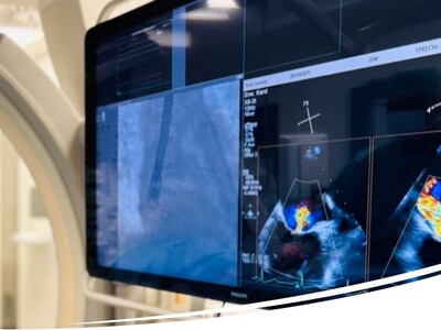 Ein Röntgenbild einer kathetergestützten Mitralklappenreparatur