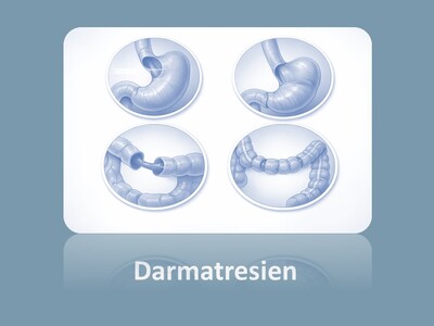 Schematische Darstellung verschiedener Darmatresien