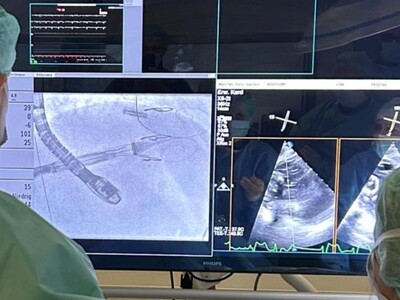 Blick über den Rücken eines Arztes auf ein Röntgenbild aus dem Katheterlabor